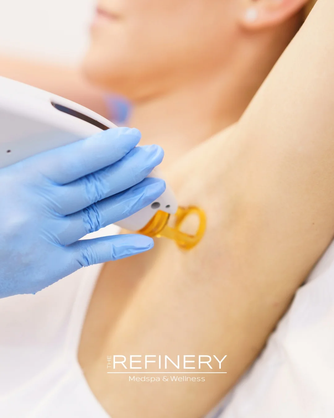 Best time to start laser hair removal