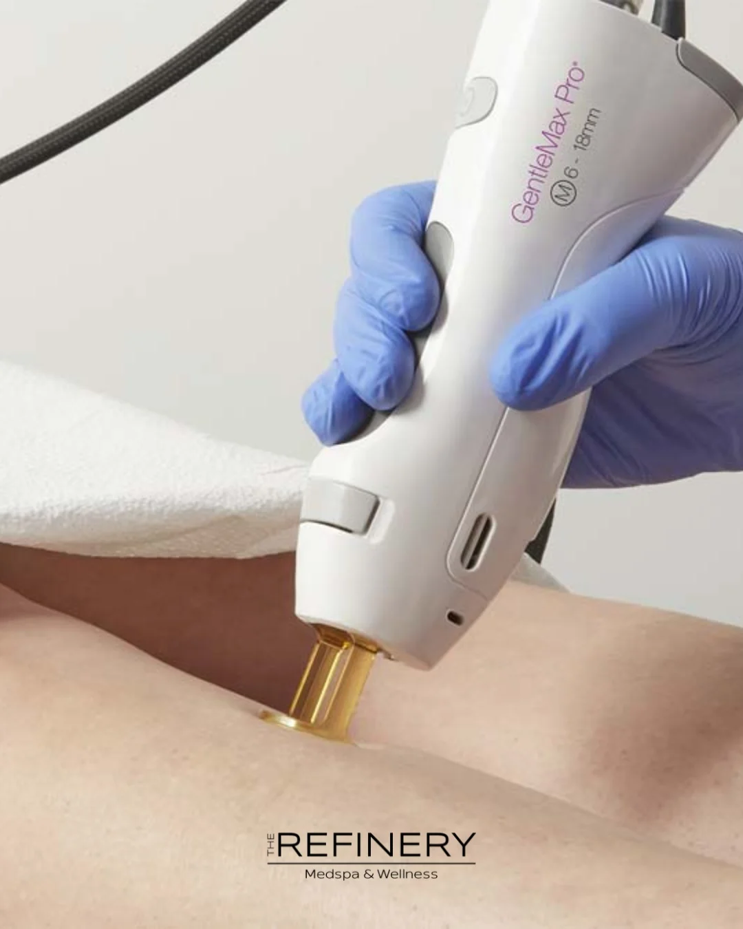 GentleMax Pro laser hair removal session