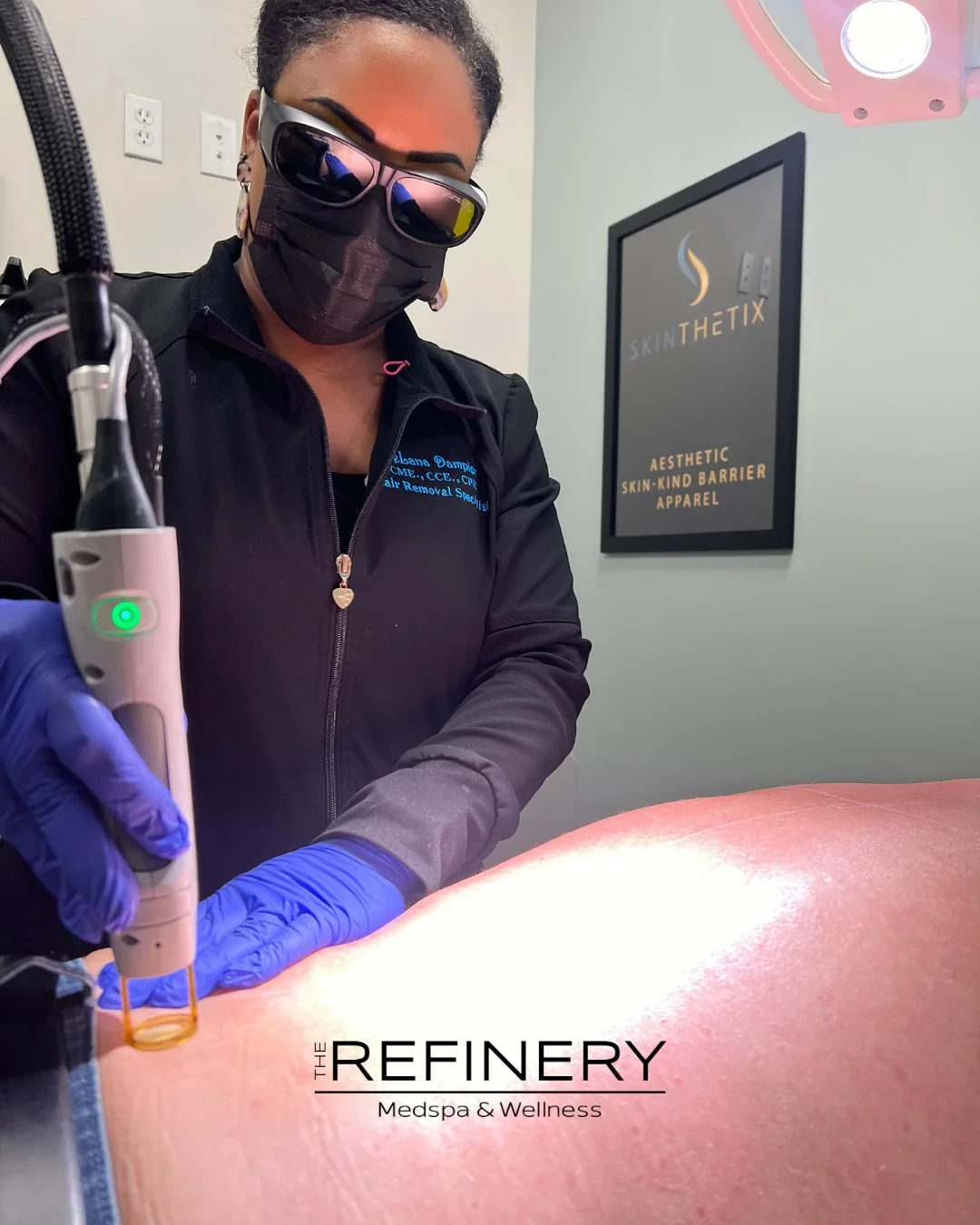 Laser hair removal treatment in West Melbourne, FL